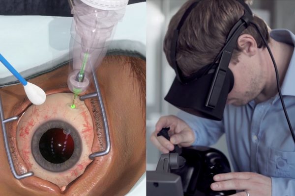 Genentech VR to Train Eye Surgeons