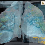VR-Trip Takes Inside an Infected COVID-19 Lung