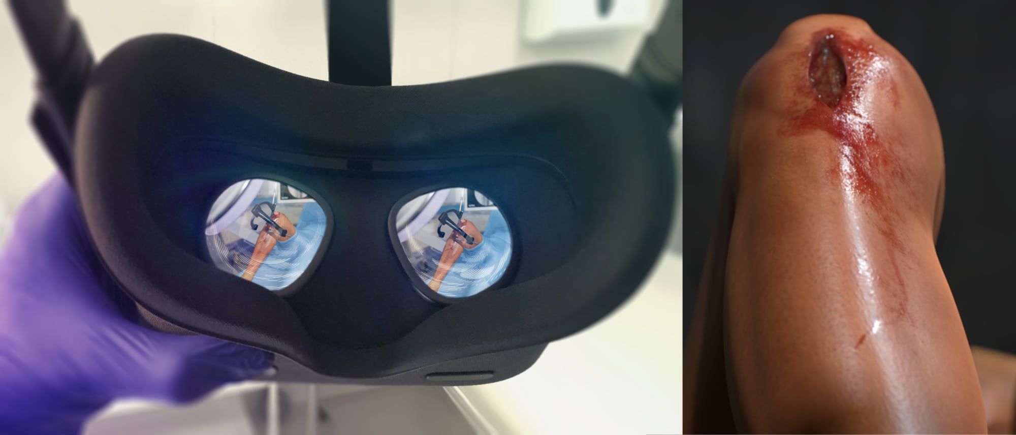 Osso VR Update